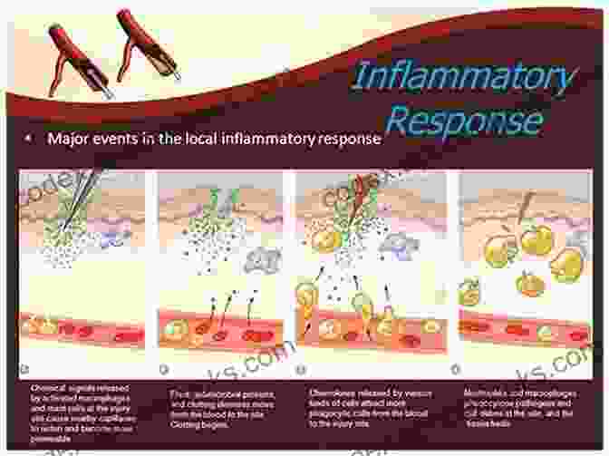 A Visual Representation Of Inflammation, Showcasing The Complex Process Of Immune Response Characterized By Redness, Swelling, Heat, And Pain. Why We Get Sick: The Hidden Epidemic At The Root Of Most Chronic Disease And How To Fight It