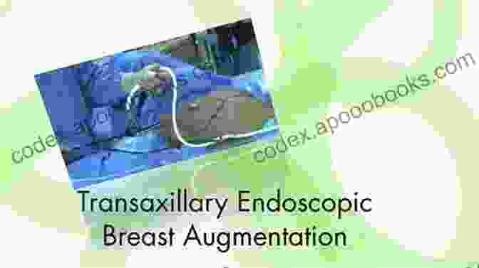 Dr. Jean Marie Magnien Performing Endoscopic Transaxillary Augmentation Mammoplasty (ETAM) Endoscopic Transaxillary Augmentation Mammoplasty Jean Marie Magnien