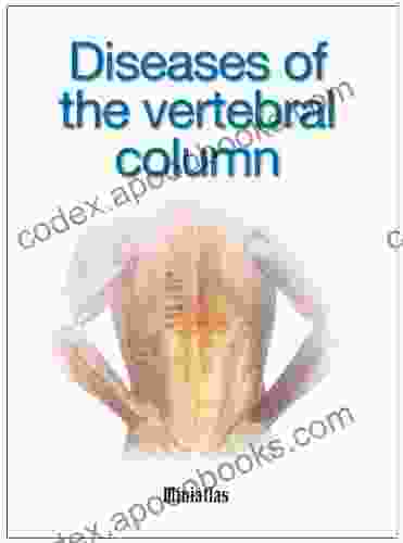Diseases Of The Vertebral Column Miniatlas